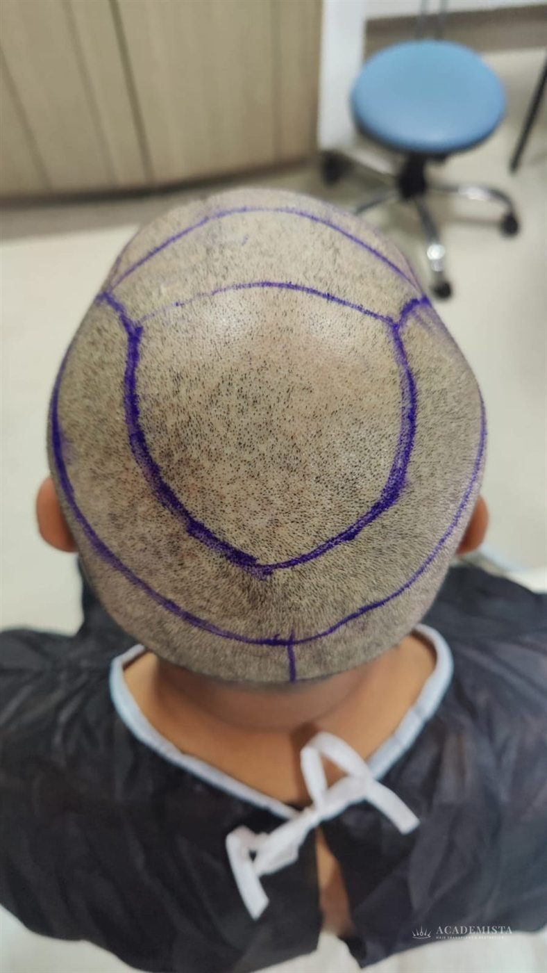Dr. Ahmed: The design marked out