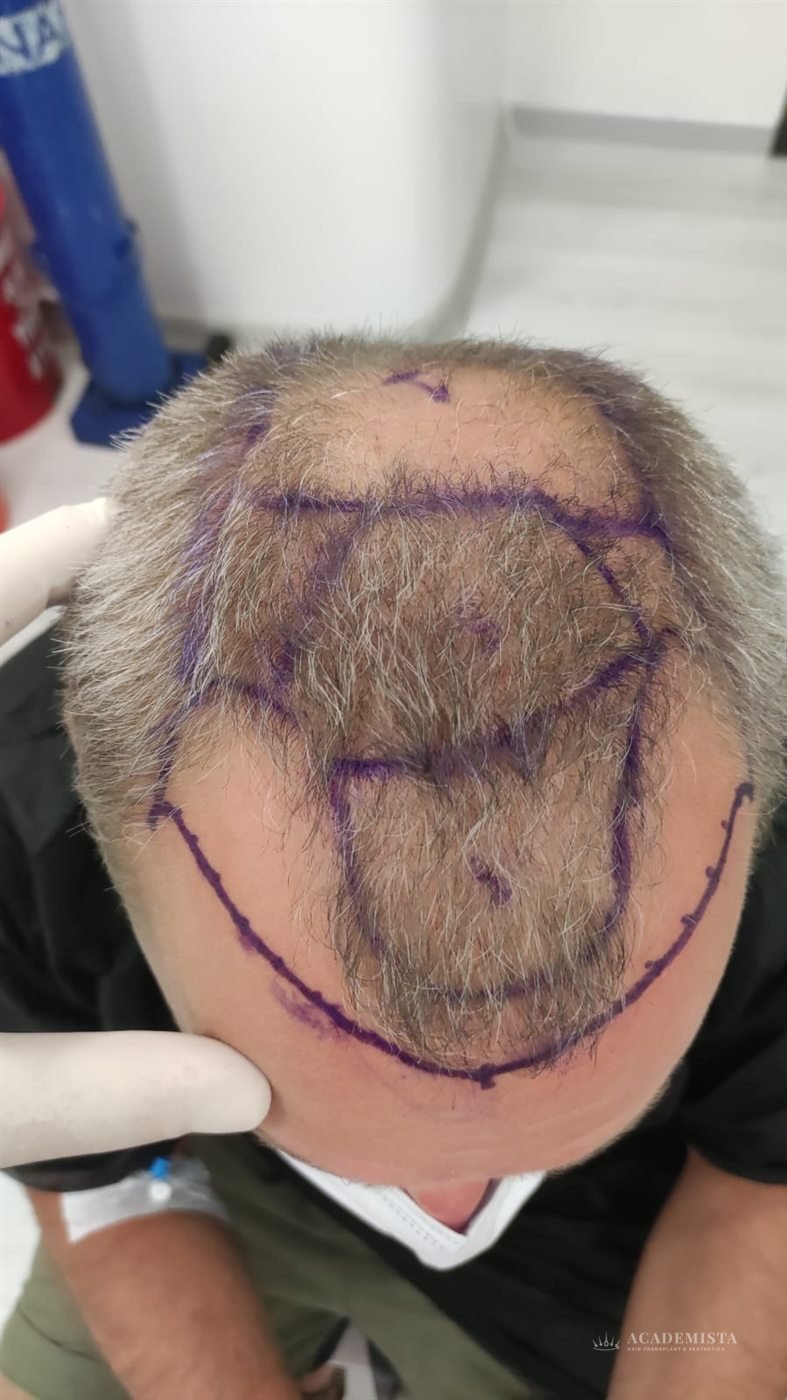 Alex: The design marked out