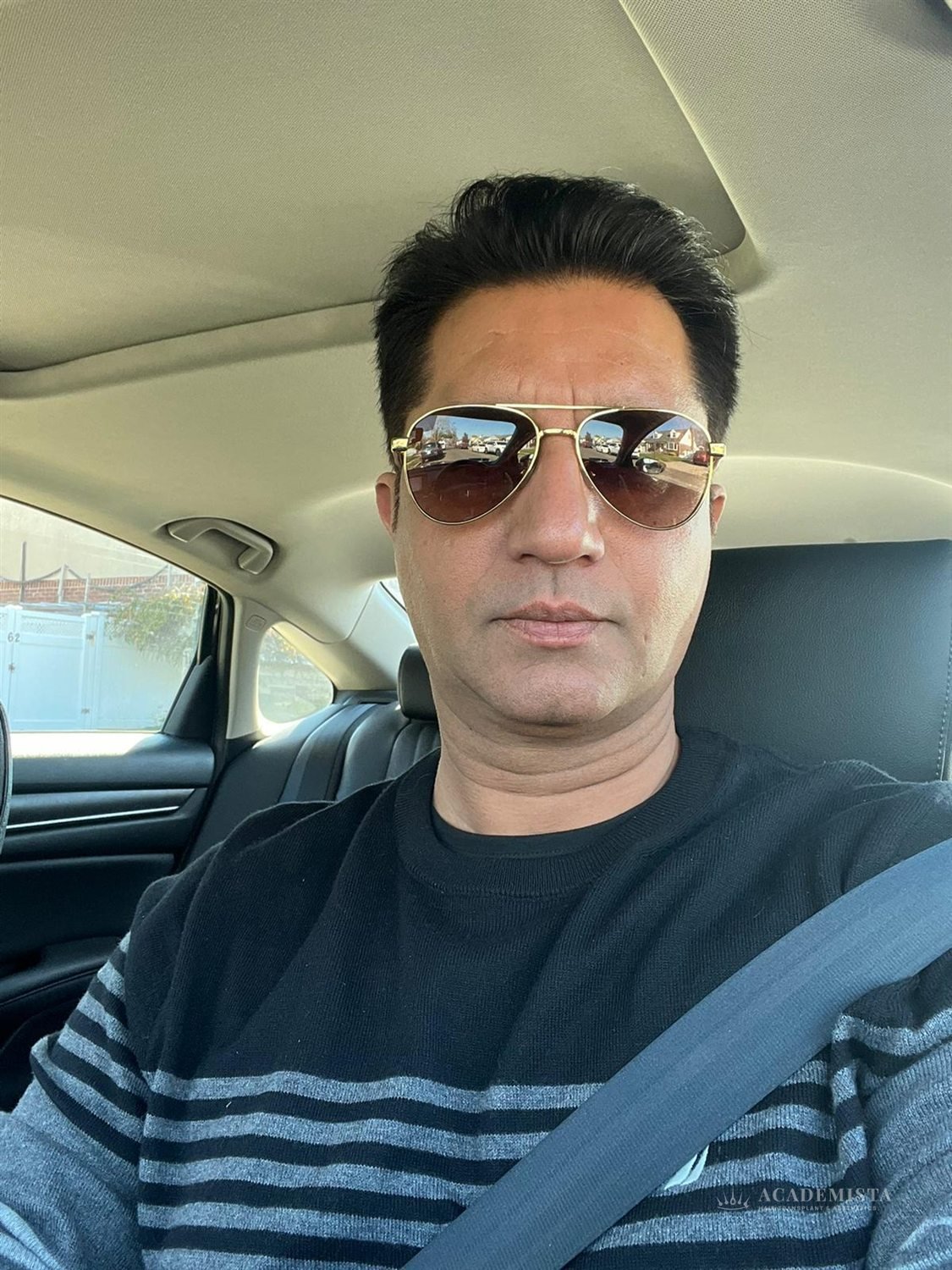 Atif after his hair transplant