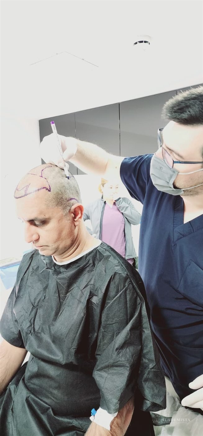 Atif: During the procedure