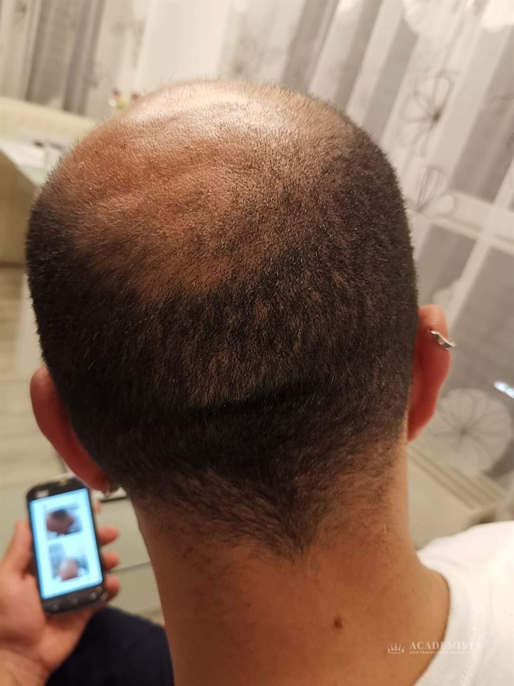 Franco: Day 0, immediately after