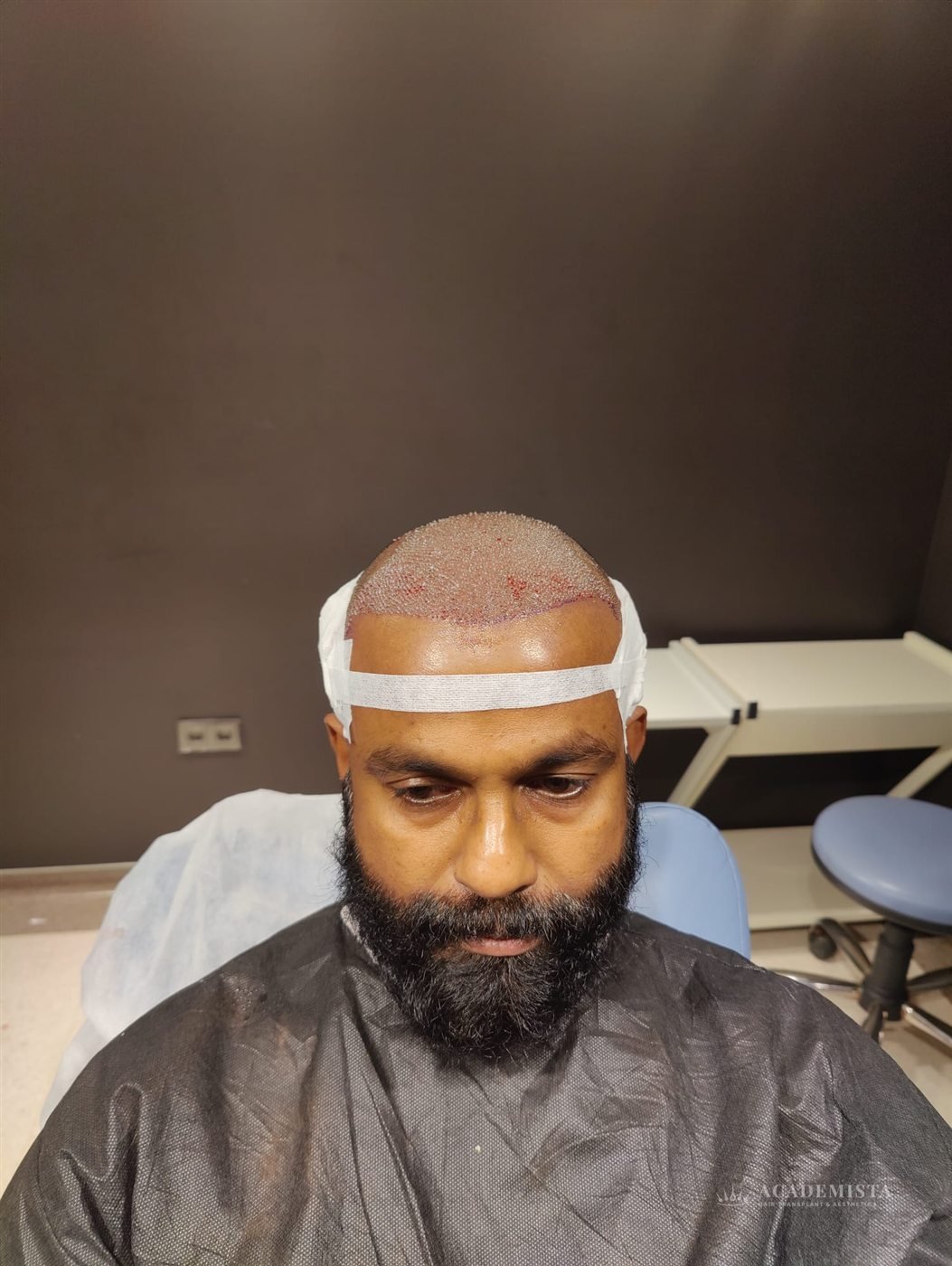 Phinil Tomas: Day 0, after the procedure