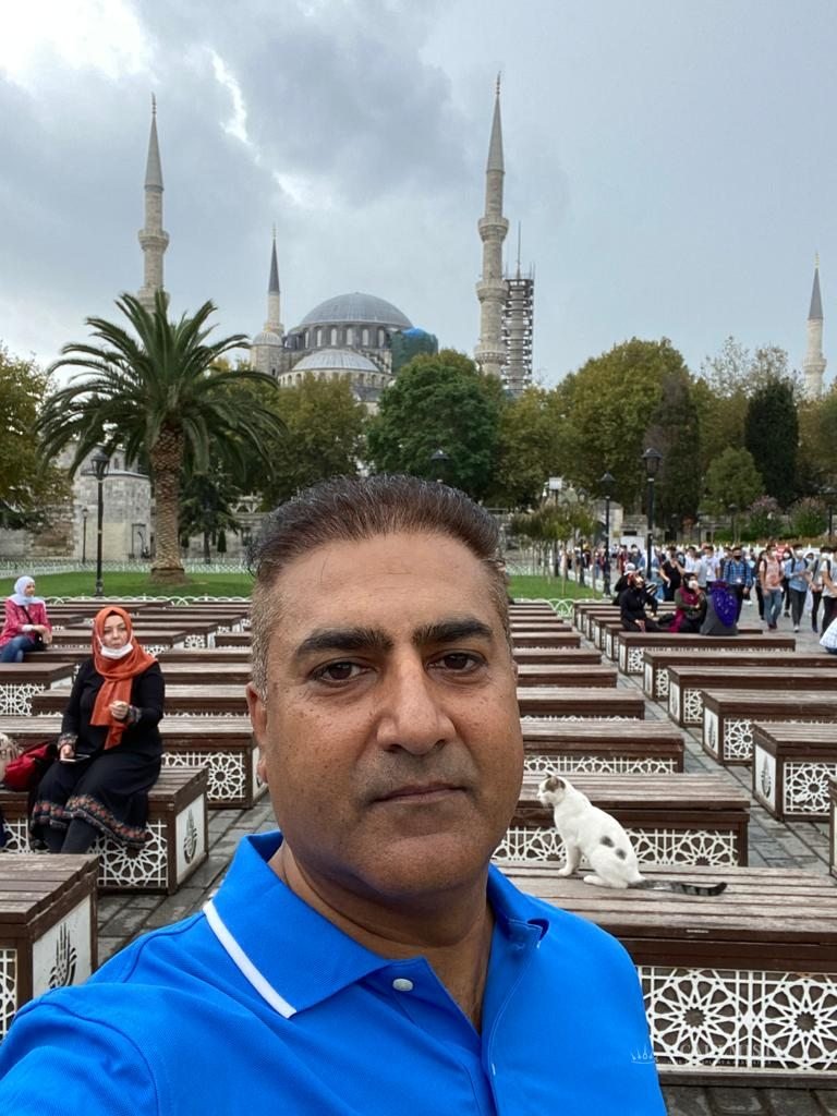Sami after his hair transplant