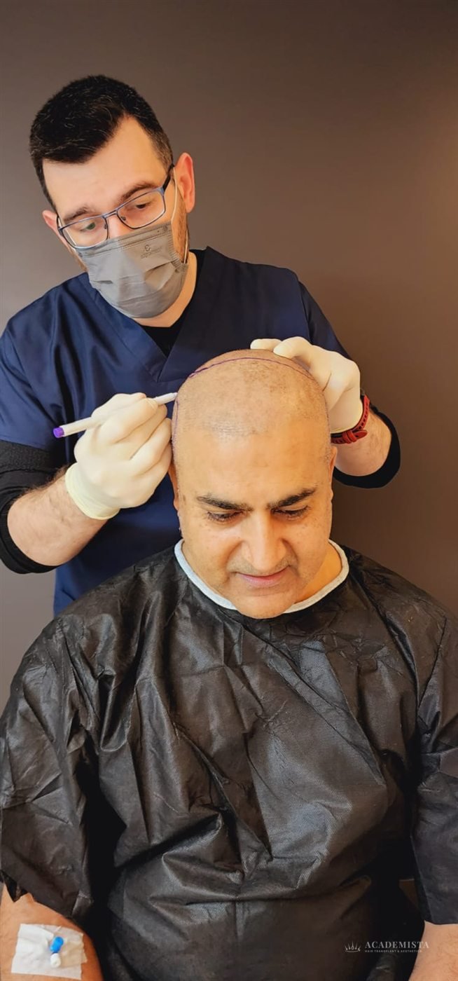 Sami: During the procedure