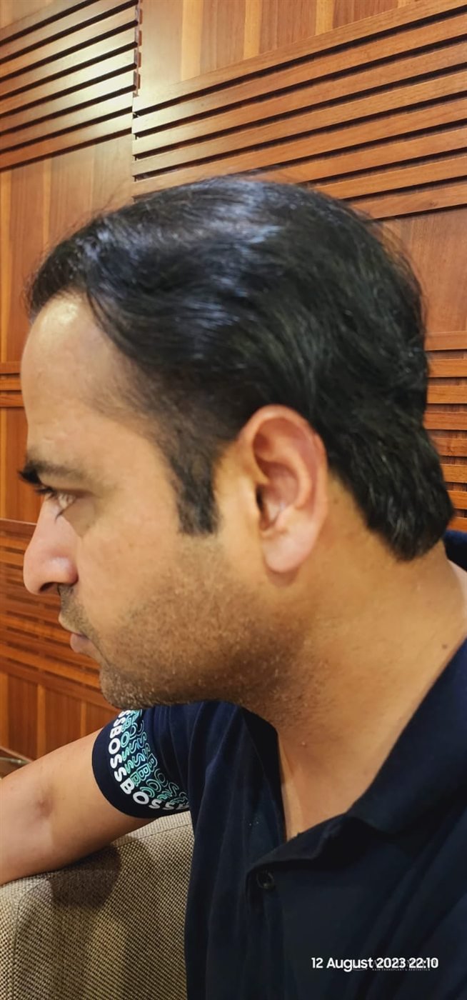 Shahbaz: The result, in profile