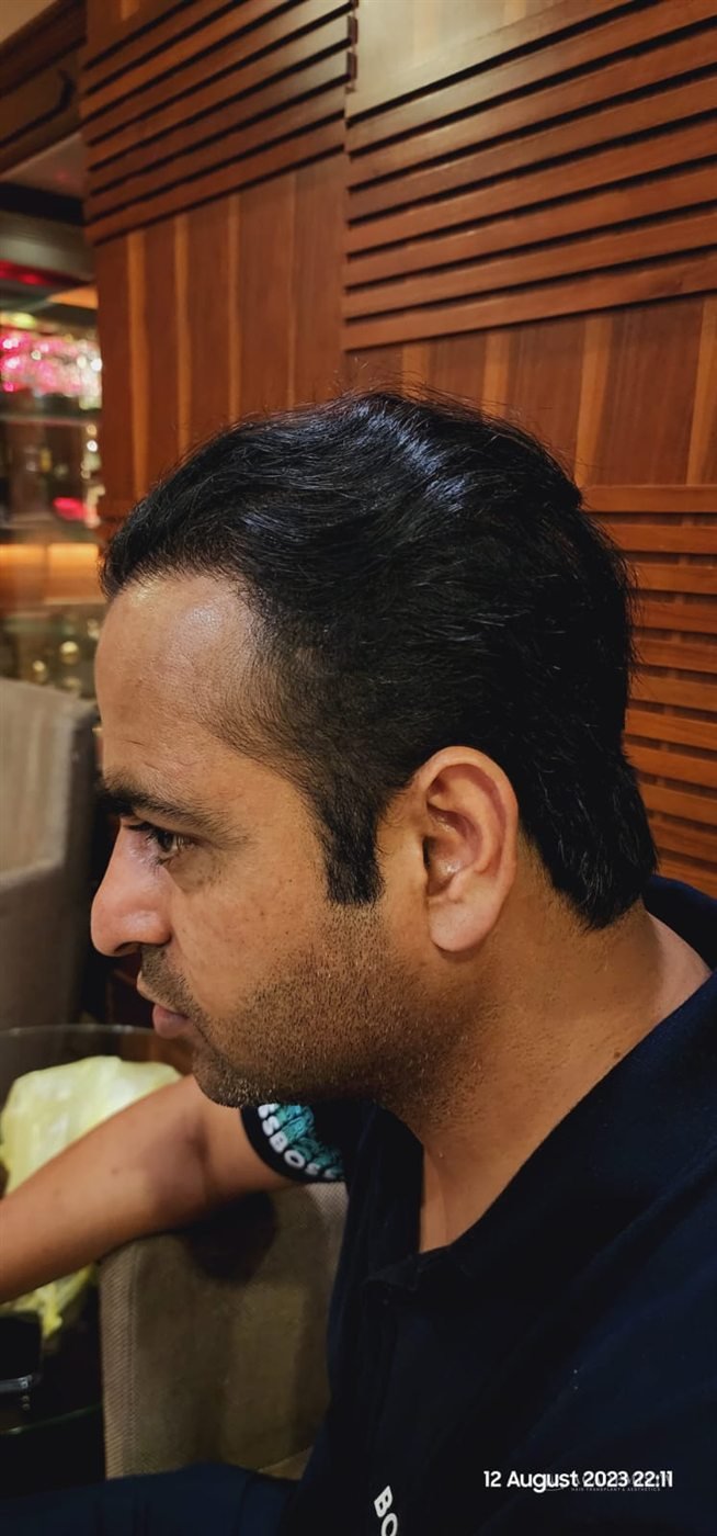 Shahbaz: The result, other side
