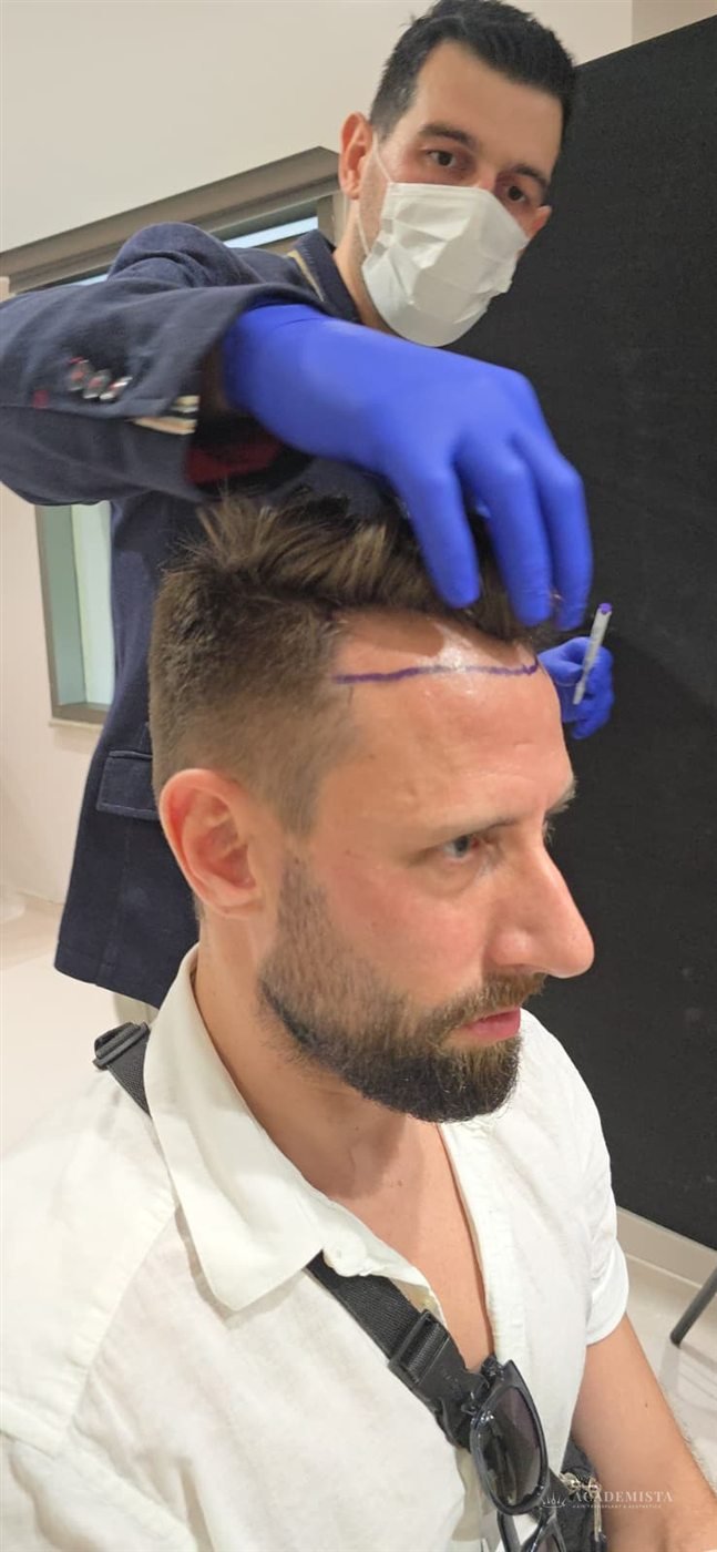 Stefan: During the procedure